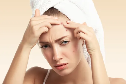 Woman with pimples_How to Get Rid of Pimples Fast